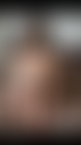 Geblurrte Content-Vorschau