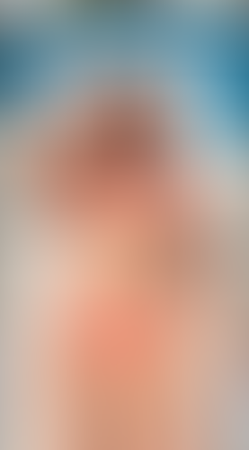Geblurrte Content-Vorschau