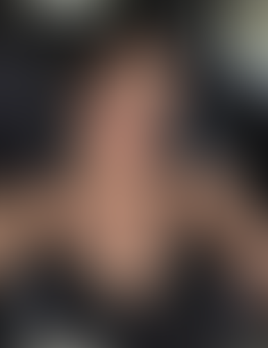 Geblurrte Content-Vorschau