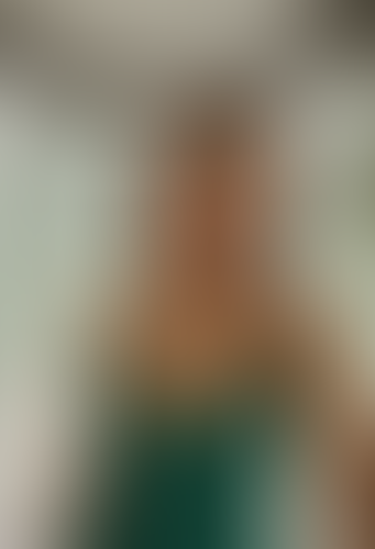 Geblurrte Content-Vorschau