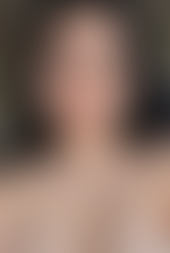 Geblurrte Content-Vorschau