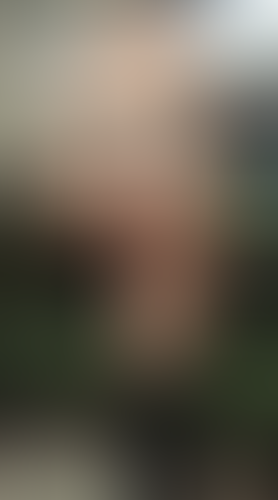 Geblurrte Content-Vorschau