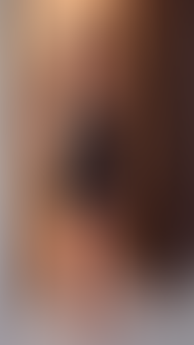 Geblurrte Content-Vorschau