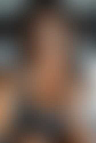 Geblurrte Content-Vorschau