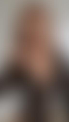 Geblurrte Content-Vorschau