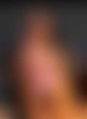 Geblurrte Content-Vorschau