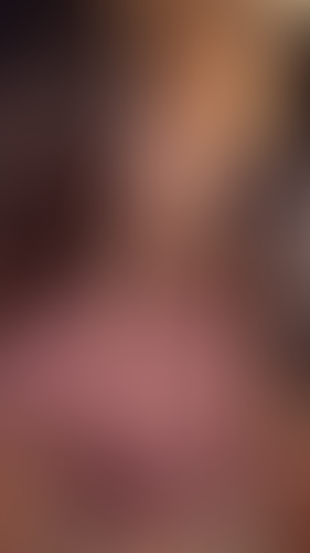 Geblurrte Content-Vorschau