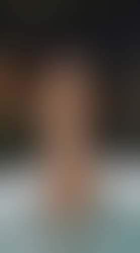 Geblurrte Content-Vorschau