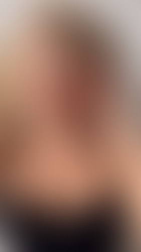 Geblurrte Content-Vorschau