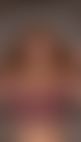 Geblurrte Content-Vorschau