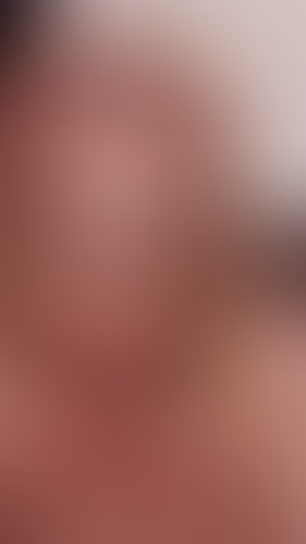 Geblurrte Content-Vorschau