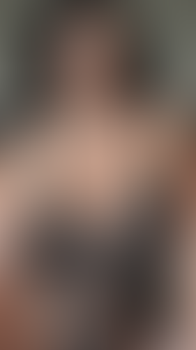 Geblurrte Content-Vorschau