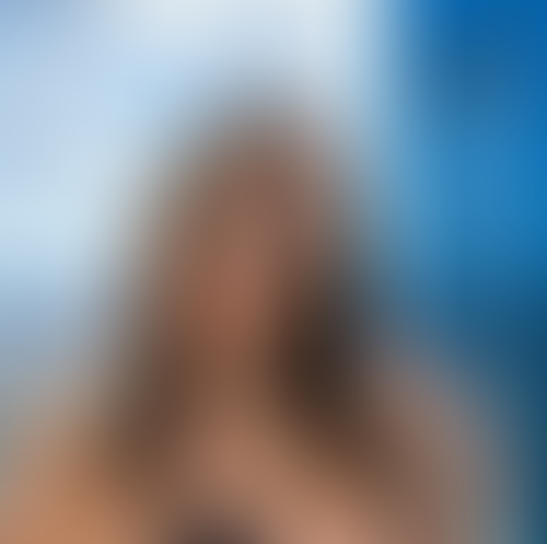 Geblurrte Content-Vorschau