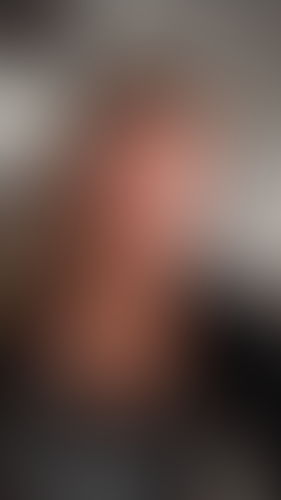 Geblurrte Content-Vorschau