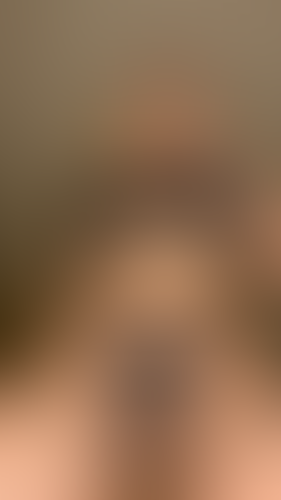Geblurrte Content-Vorschau