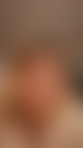 Geblurrte Content-Vorschau