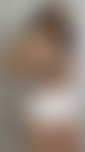 Geblurrte Content-Vorschau
