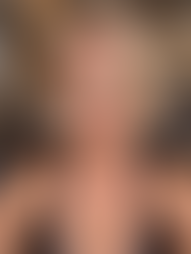 Geblurrte Content-Vorschau