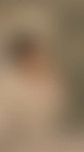 Geblurrte Content-Vorschau