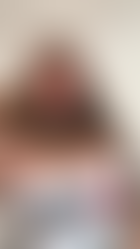 Geblurrte Content-Vorschau