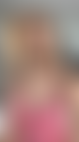 Geblurrte Content-Vorschau