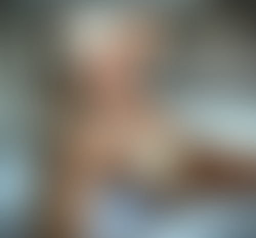 Geblurrte Content-Vorschau