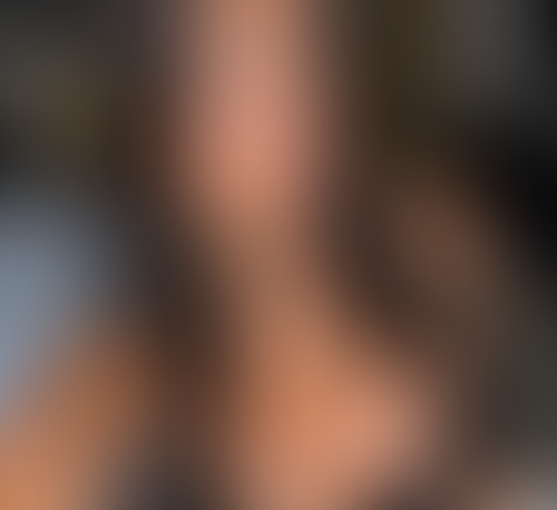 Geblurrte Content-Vorschau