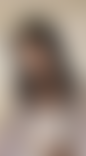 Geblurrte Content-Vorschau