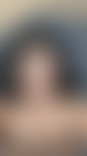 Geblurrte Content-Vorschau
