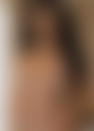 Geblurrte Content-Vorschau