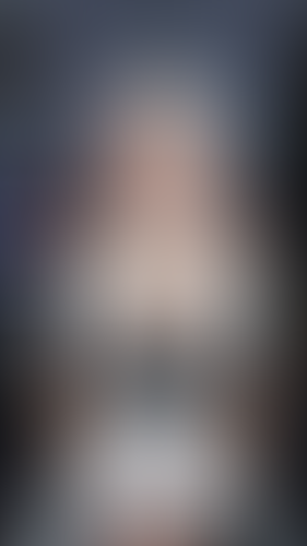 Geblurrte Content-Vorschau