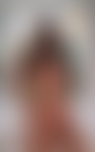Geblurrte Content-Vorschau