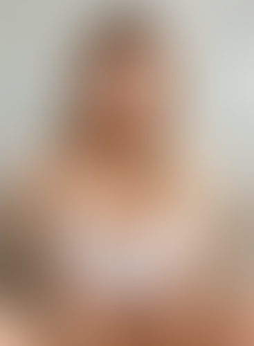 Geblurrte Content-Vorschau
