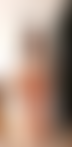 Geblurrte Content-Vorschau