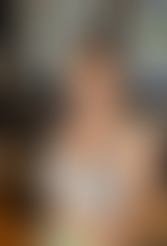 Geblurrte Content-Vorschau