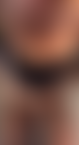 Geblurrte Content-Vorschau