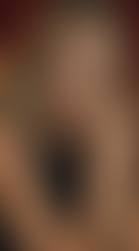 Geblurrte Content-Vorschau