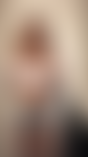 Geblurrte Content-Vorschau