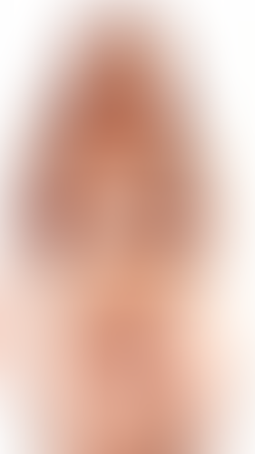 Geblurrte Content-Vorschau