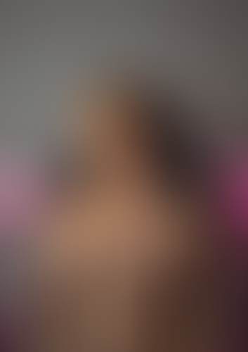 Geblurrte Content-Vorschau