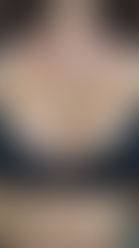Geblurrte Content-Vorschau