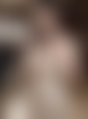 Geblurrte Content-Vorschau