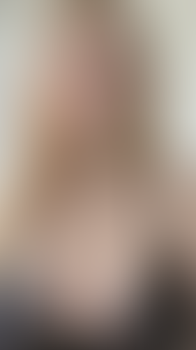 Geblurrte Content-Vorschau