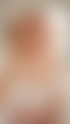 Geblurrte Content-Vorschau