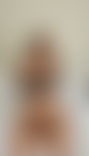 Geblurrte Content-Vorschau