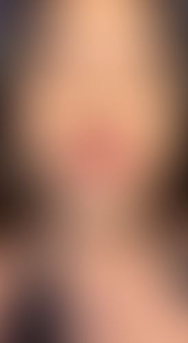 Geblurrte Content-Vorschau