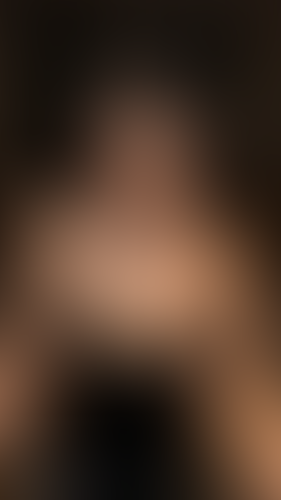 Geblurrte Content-Vorschau