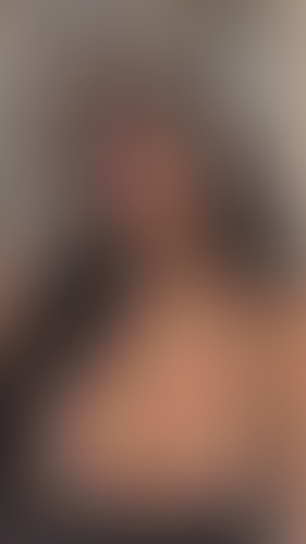 Geblurrte Content-Vorschau