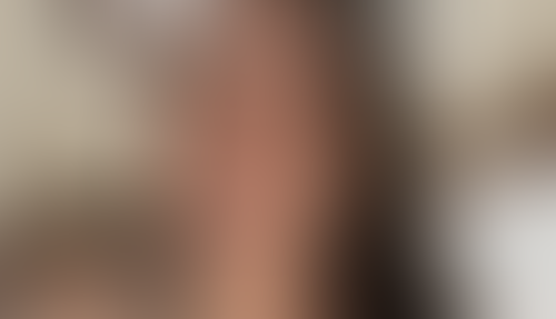Geblurrte Content-Vorschau