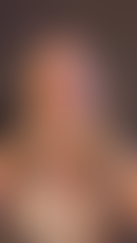 Geblurrte Content-Vorschau